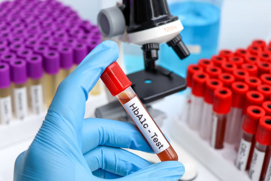 Wholesale HbA1c Test Kits